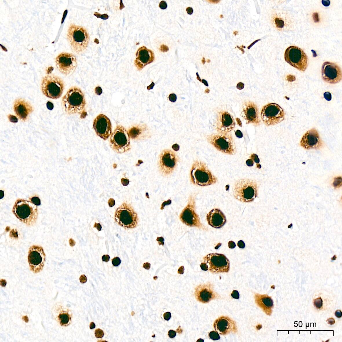 SFPQ Antibody (8Y5S6)