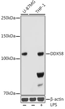 RIG-I Antibody (6K8P2)