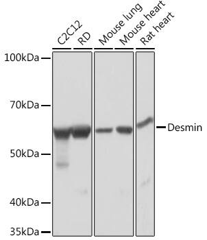 Desmin Antibody (6O9O4)