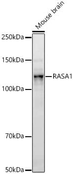 Ras-GAP Antibody (6W10G6)
