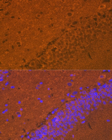 Synuclein alpha/beta Antibody (9E9X5)