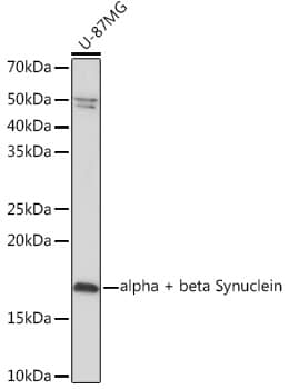 Synuclein alpha/beta Antibody (9E9X5)