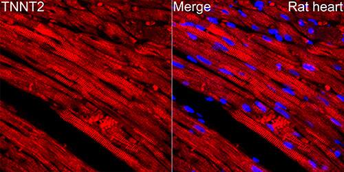 Cardiac Troponin T Antibody (10H9D8)