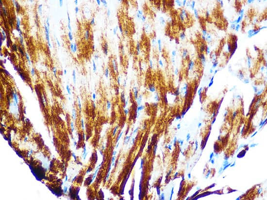 Cardiac Troponin T Antibody (10H9D8)