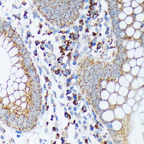 SPRY2 Antibody (10M8H1)