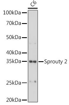 SPRY2 Antibody (10M8H1)