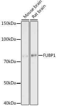 FUBP1 Antibody (1G6X5)