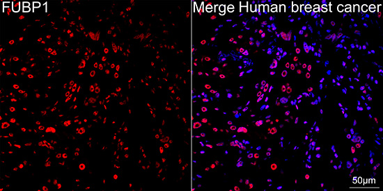 FUBP1 Antibody (1G6X5)