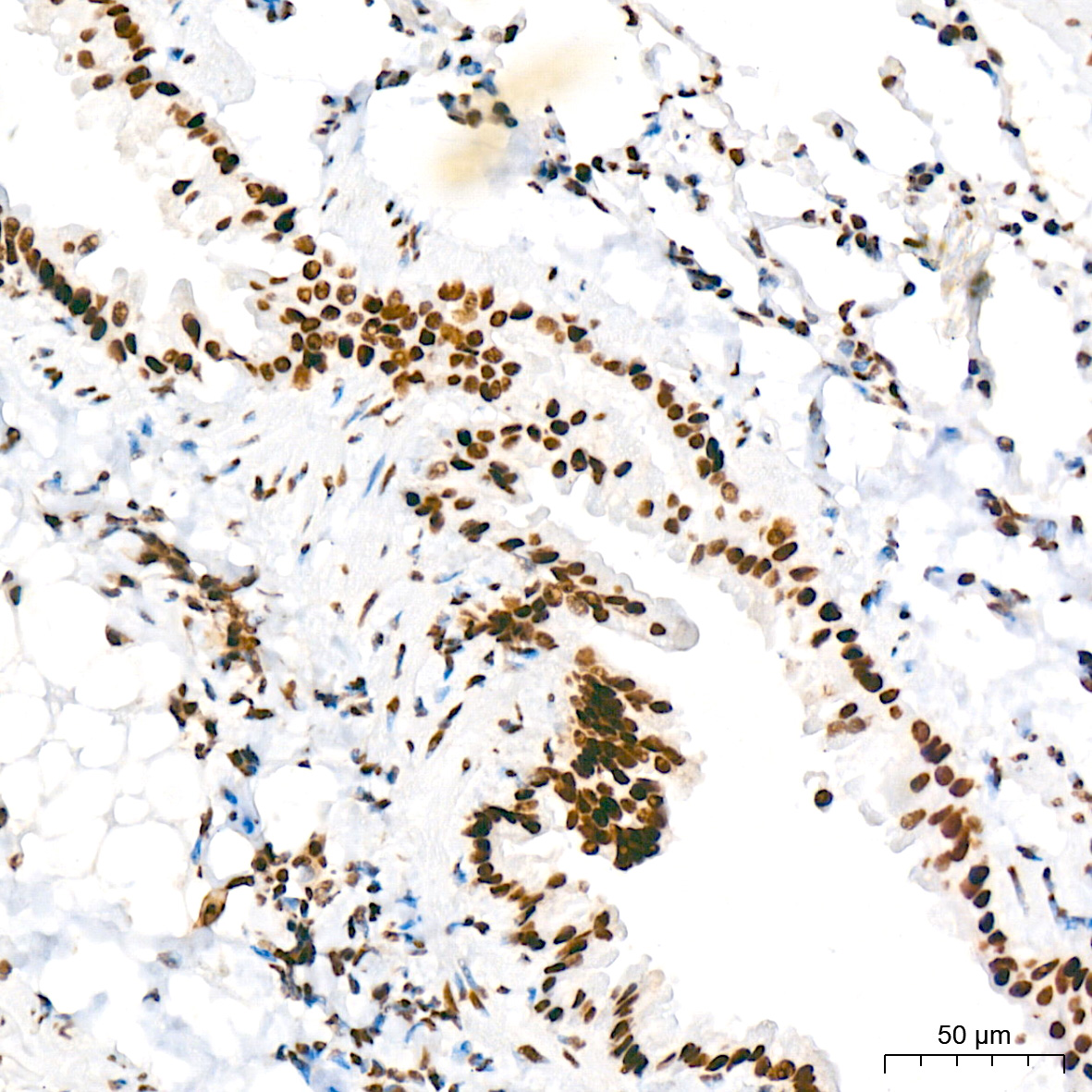 FUBP1 Antibody (1G6X5)