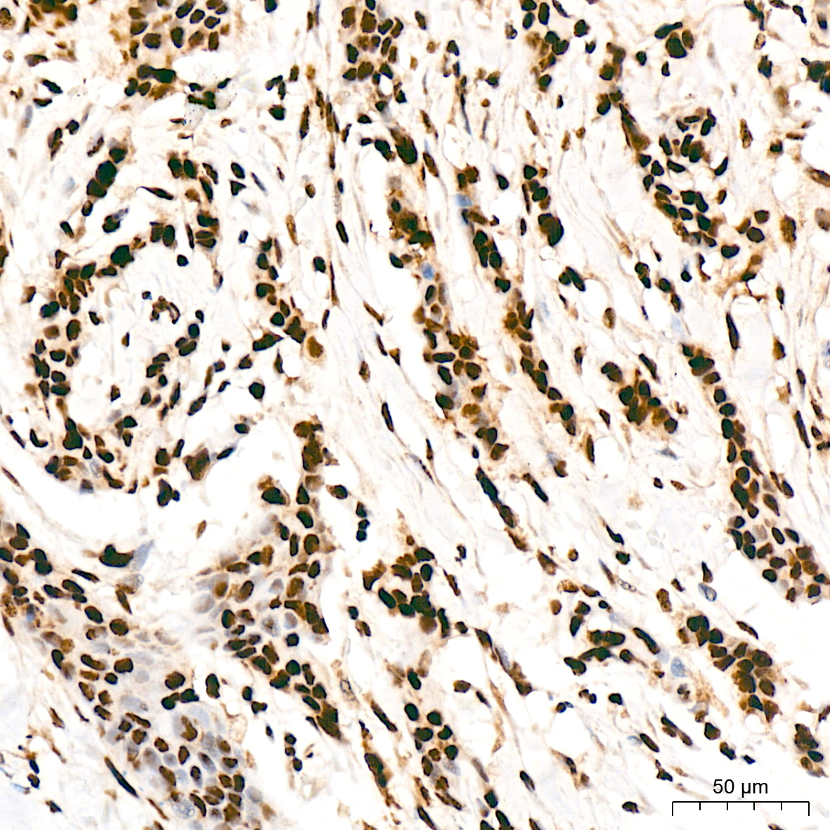FUBP1 Antibody (1G6X5)