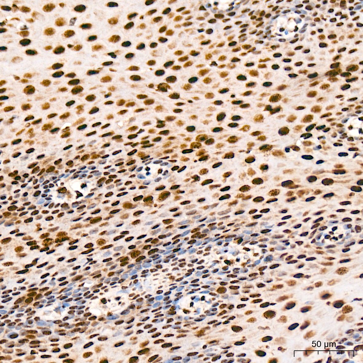 FUBP1 Antibody (1G6X5)