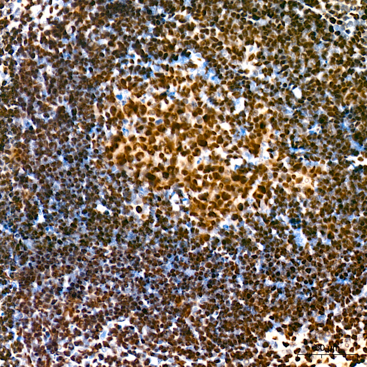 FUBP1 Antibody (1G6X5)