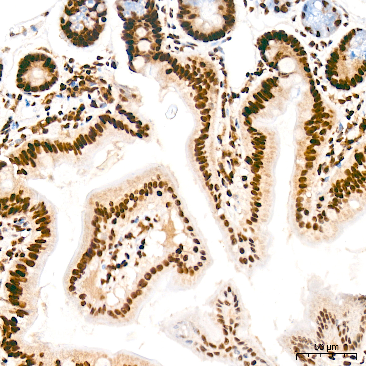 FUBP1 Antibody (1G6X5)