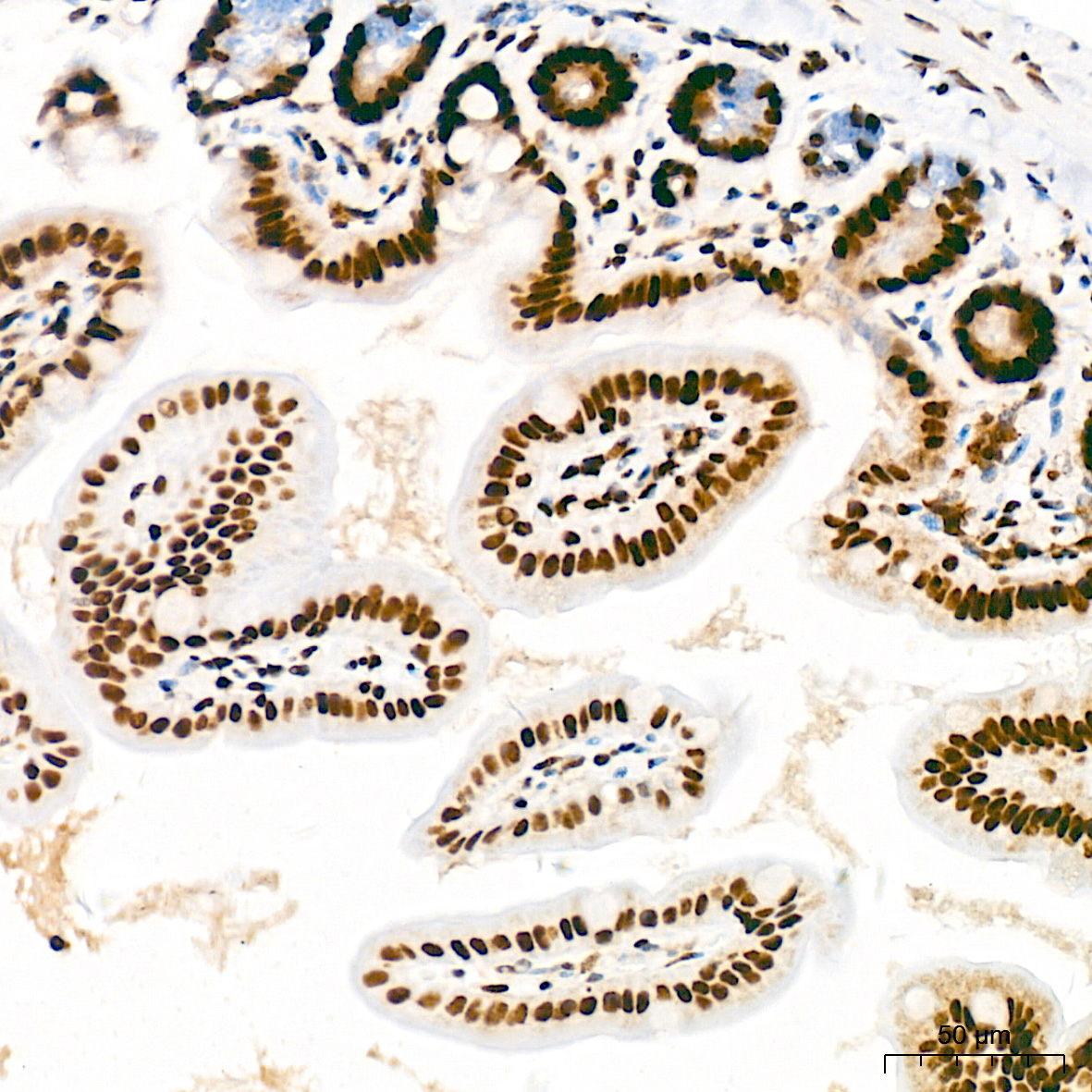 FUBP1 Antibody (1G6X5)