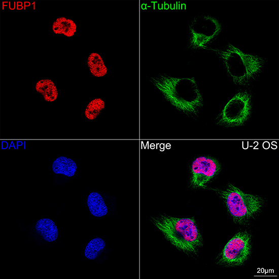 FUBP1 Antibody (1G6X5)