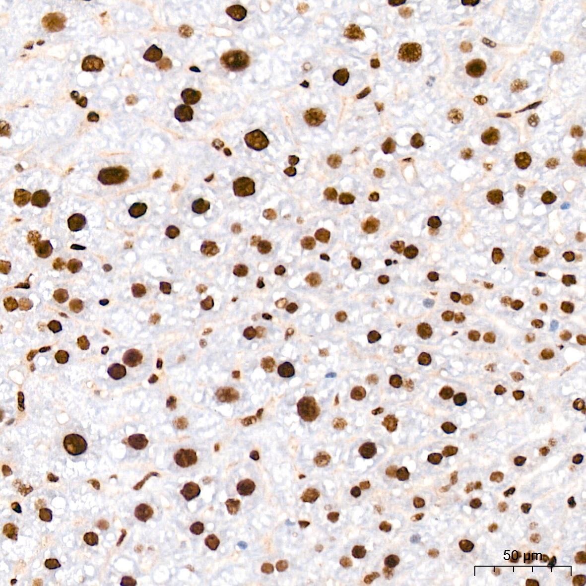FUBP1 Antibody (1G6X5)