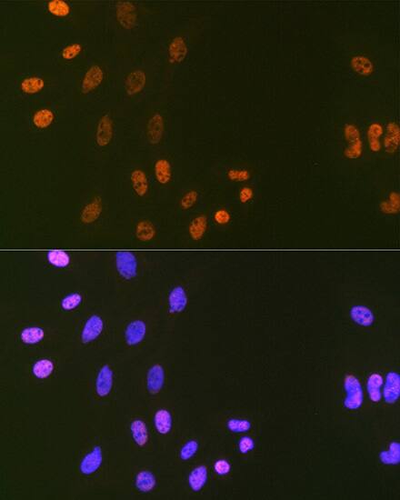 DNA Ligase I Antibody (0D6M4)