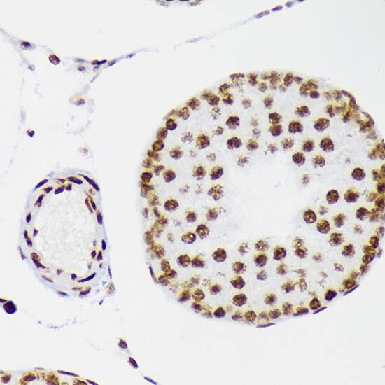 DNA Ligase I Antibody (0D6M4)