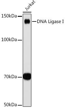 DNA Ligase I Antibody (0D6M4)