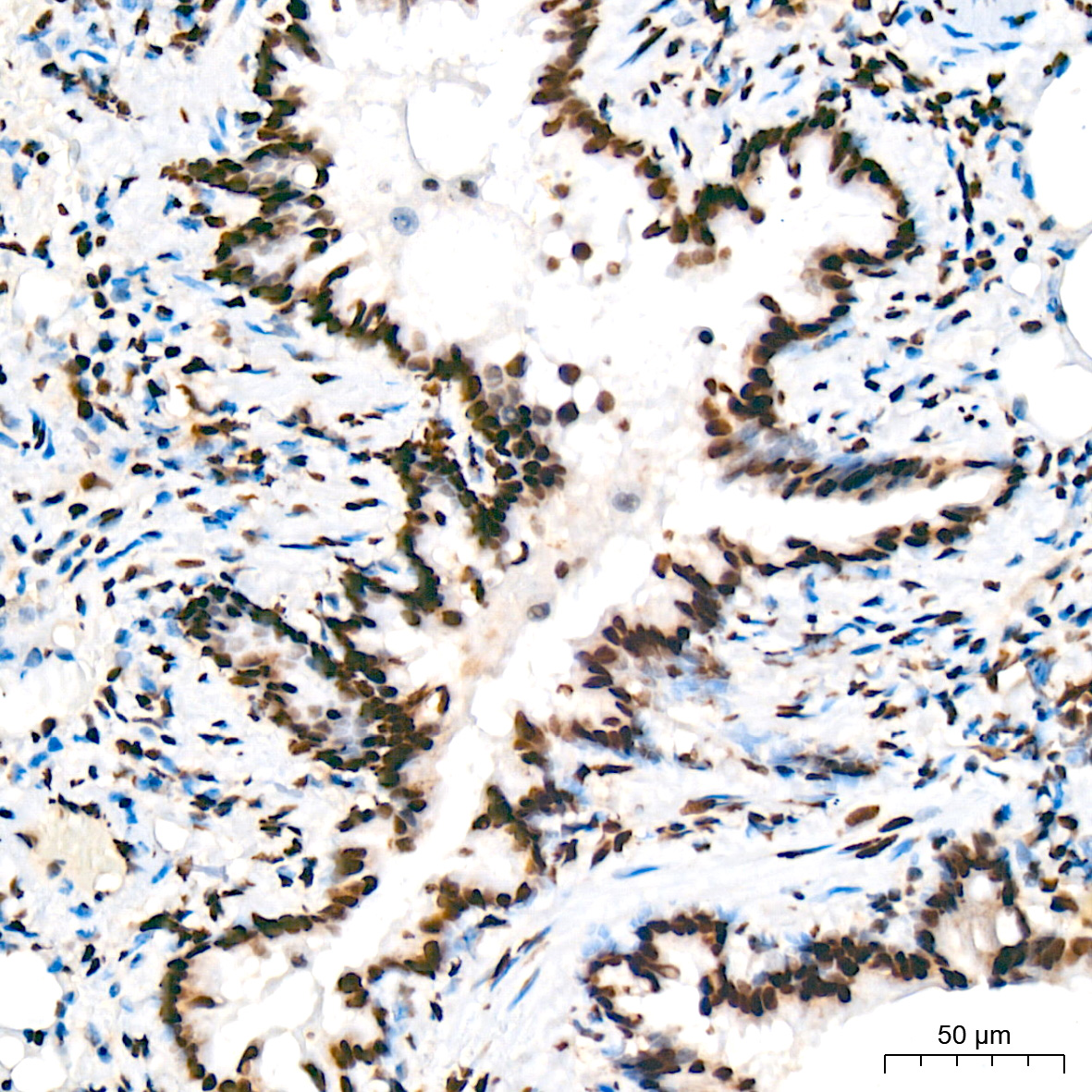 DNA Ligase I Antibody (0D6M4)