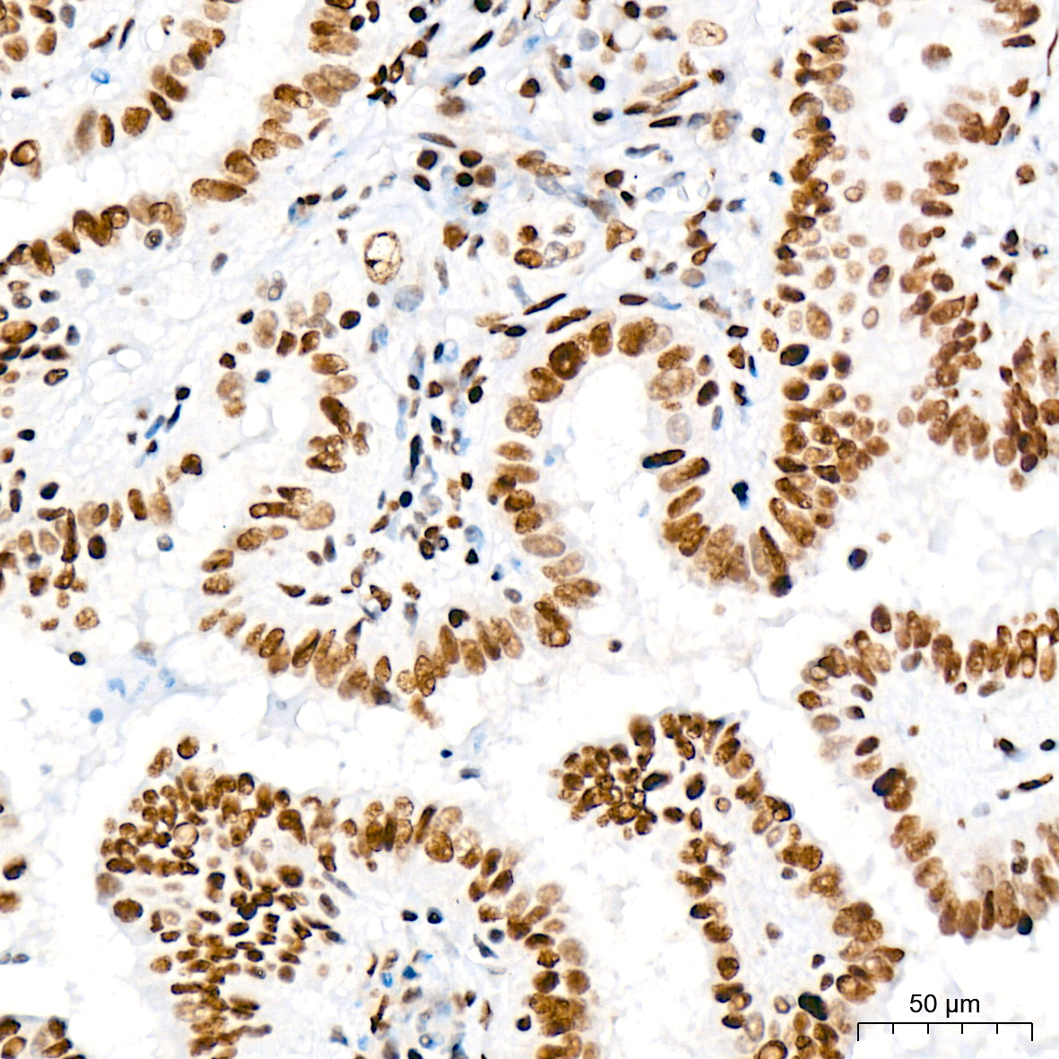 DNA Ligase I Antibody (0D6M4)