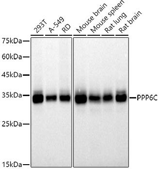 PPP6C Antibody (6O2N8)