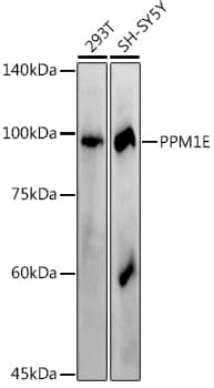 PPM1E Antibody (2L7W0)