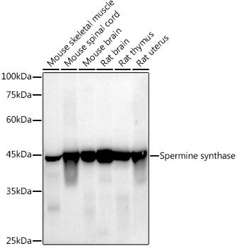 Spermine synthase Antibody (1U7C7)