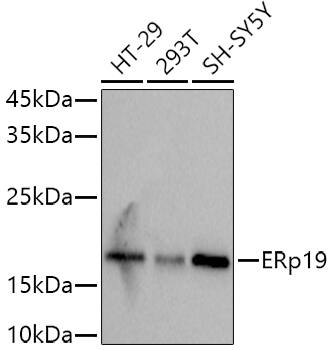 TXNDC12 Antibody (9J6L2)