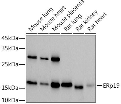 TXNDC12 Antibody (9J6L2)