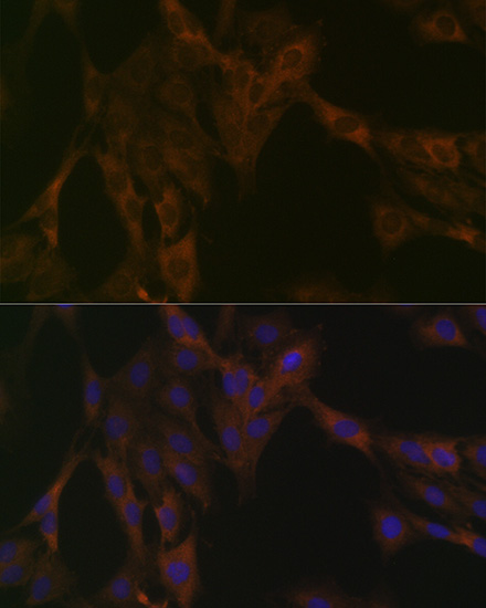 DDX6 Antibody (6F9I6)
