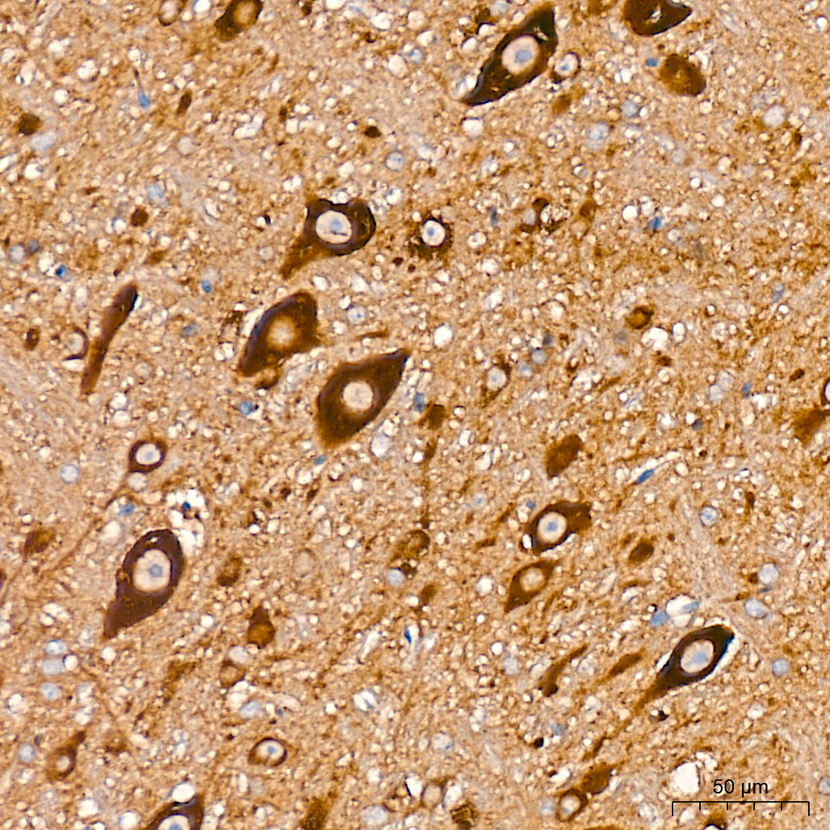 RALBP1 Antibody (5C10W9)