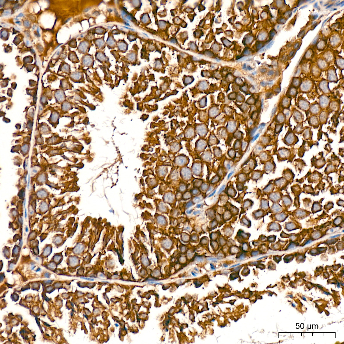 RALBP1 Antibody (5C10W9)