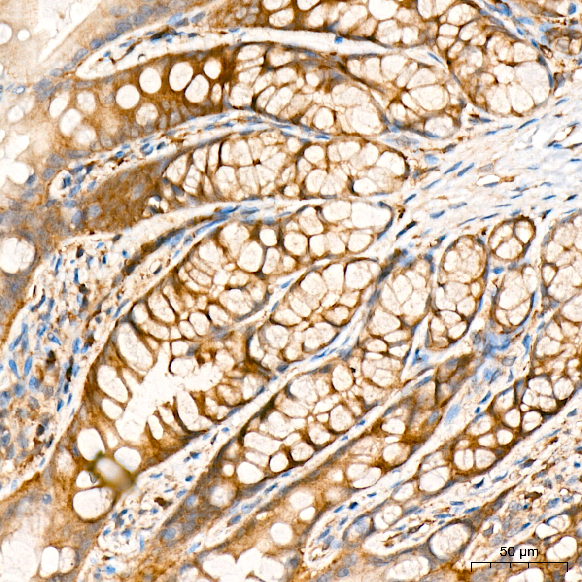 RALBP1 Antibody (5C10W9)