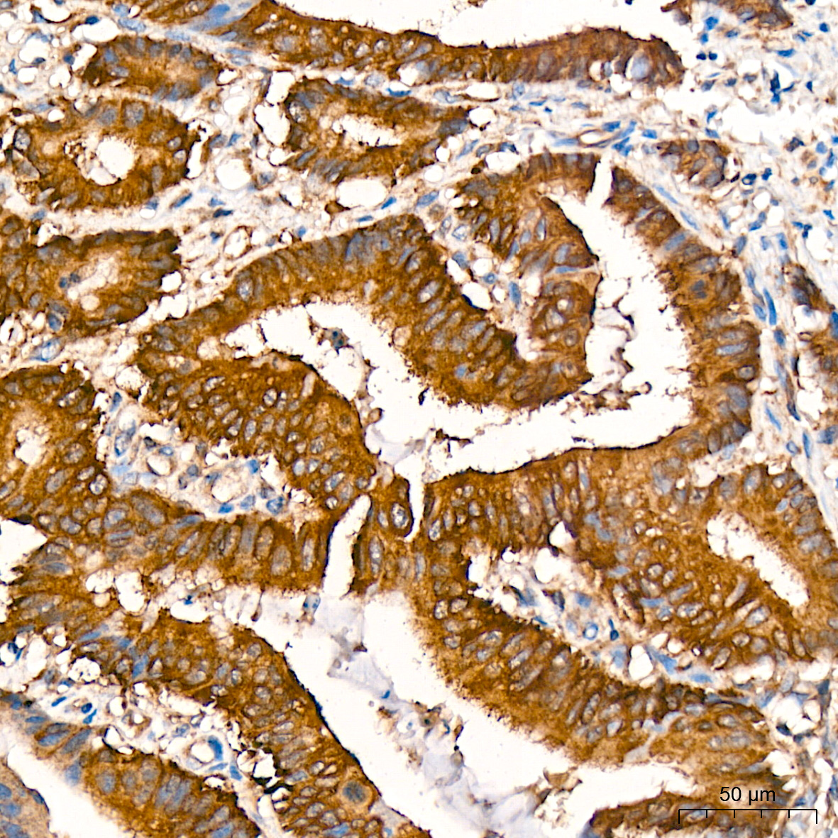 RALBP1 Antibody (5C10W9)