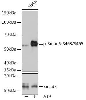 Smad5 [p Ser465, p Ser463] Antibody (8F4B10)