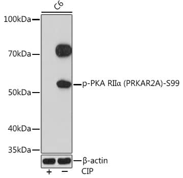 PKA R2 [p Ser99] Antibody (8K9F9)