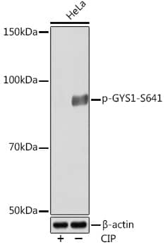 Glycogen Synthase [p Ser641] Antibody (6T9W4)