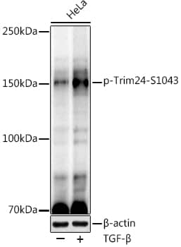 TIF1 alpha [p Ser1043] Antibody (7N5L6)