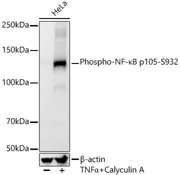 NFkB p105/p50 [p Ser932] Antibody (8B9G6)