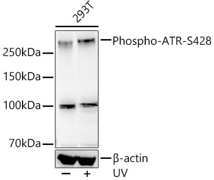 ATR [p Ser428] Antibody (7F9W10)