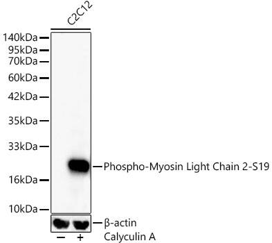 MYL9 [p Ser19] Antibody (6D8B7)