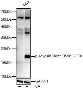 MYL9 [p Thr18] Antibody (8X1X2)