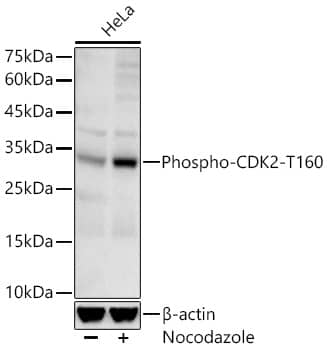 CDK2 [p Thr160] Antibody (ARC57166)