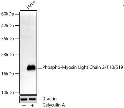 MYL9 [p Thr18, p Ser19] Antibody (4B2U5)