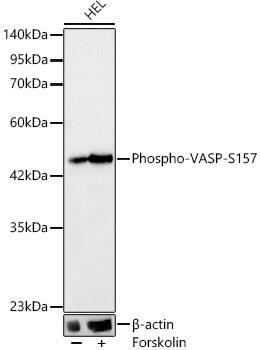 VASP [p Ser157] Antibody (2P0U3)