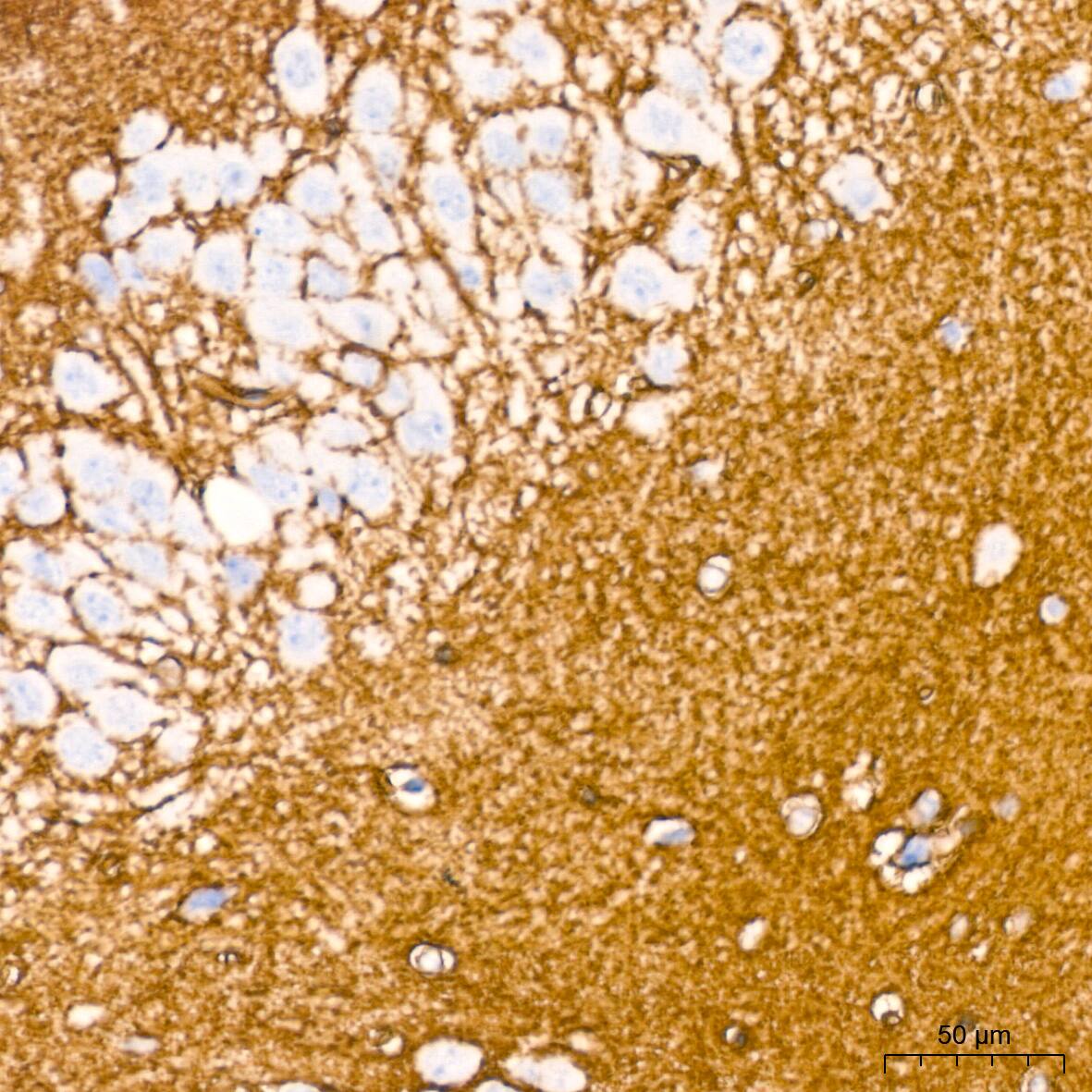 Aquaporin-4 Antibody (5A4W4)