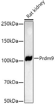 PRDM9 Antibody (1H9Z1)