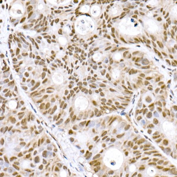 PRDM9 Antibody (1H9Z1)