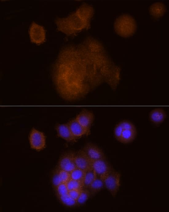 SOCS-1 Antibody (5T6Z10)
